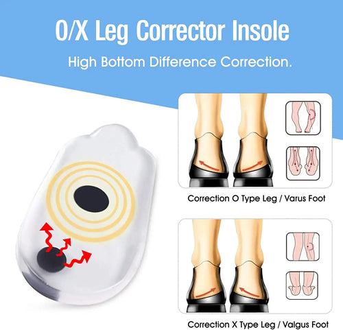 2PCS Insoles Correction Shoe Inserts Pads Effective O/X Type Leg Bowed Legs Knee Valgum Straightening for Women Men Health Care by eprolo