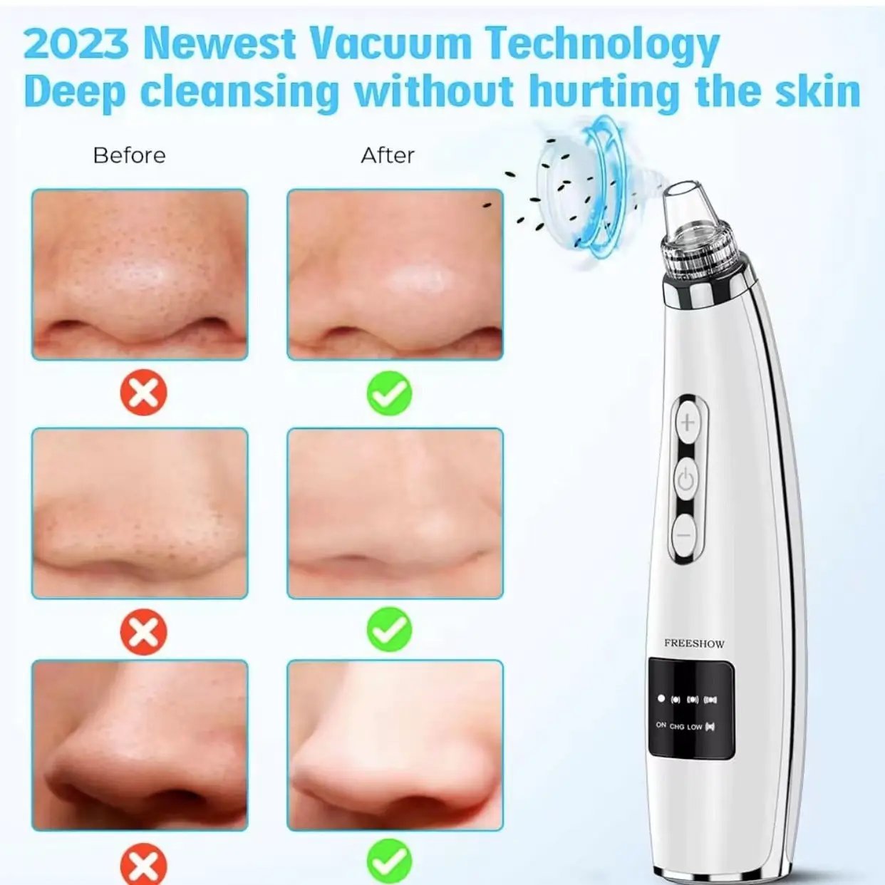 Portable Home Pore Cleaner Blackhead Device by eprolo